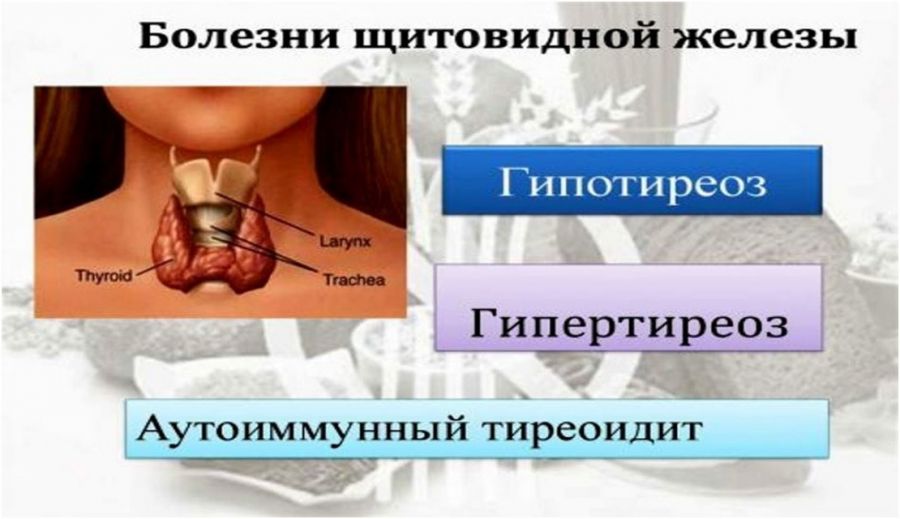 Заболевания щитовидной железы