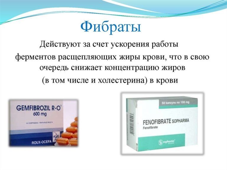 Связки